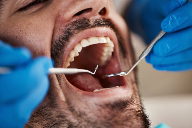 Best Cracked Tooth Emergency Dentist  in Lincoln, IL