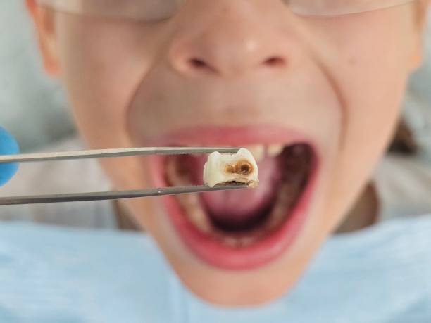 Best Emergency Gum Pain Relief  in Lincoln, IL